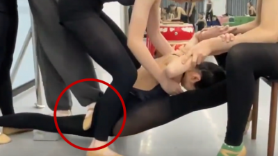 17岁舞蹈生“被老师踩断腿”毁了梦想　培训机构只愿赔逾3万